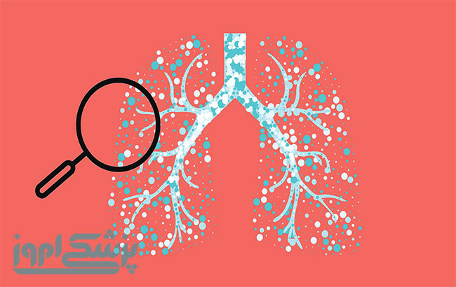 علائم،عوارض و درمان بیماری آسم